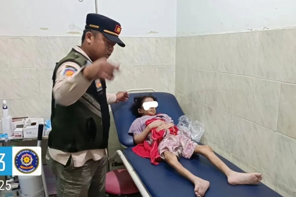 Kisah Pilu Bocah Korban Penyiksaan di Kebayoran Lama: Pernah Dibakar dan Dibacok Ayah Kandung